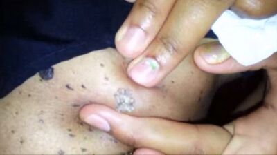 Siyah nokta sandılar ama...