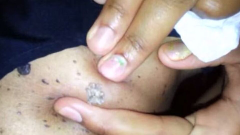 Siyah nokta sandılar ama...