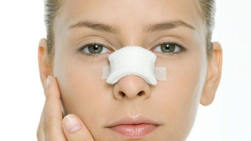 Burun estetik ameliyatlarında yeni dönem!