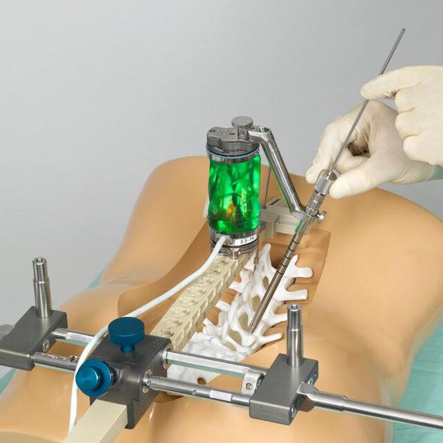 Omurga ameliyatları artık daha kolay!