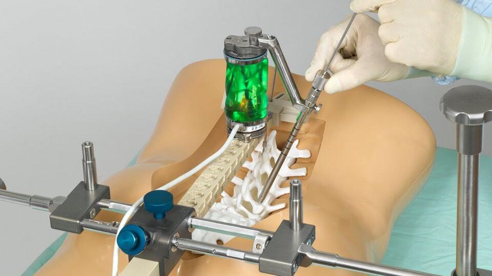 Omurga ameliyatları artık daha kolay!