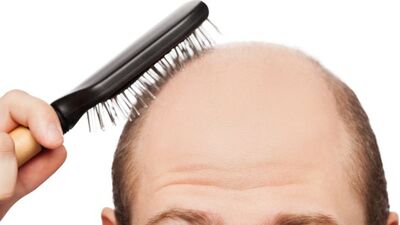 Kelliğe ve beyazlayan saçlara 'kök'ten çözüm!