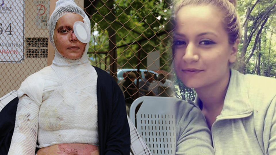 Daha önce kulağını koparmıştı, şimdi de...