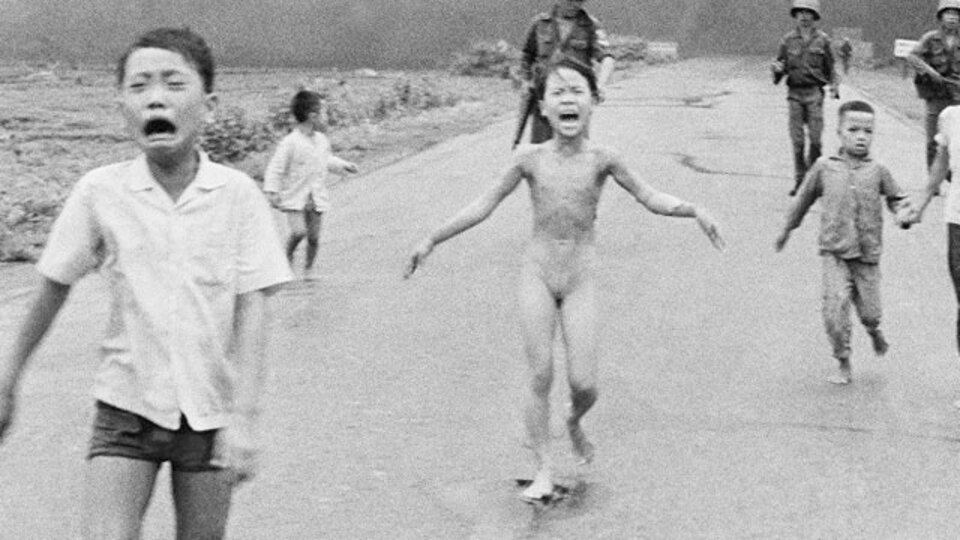 'Napalm kızı'nın yaralarına 43 yıl sonra tedavi