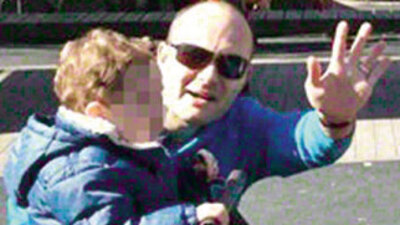 Bir gözünü kaybetti