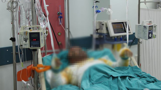 Kızı için kendini yakan Kobanili baba öldü