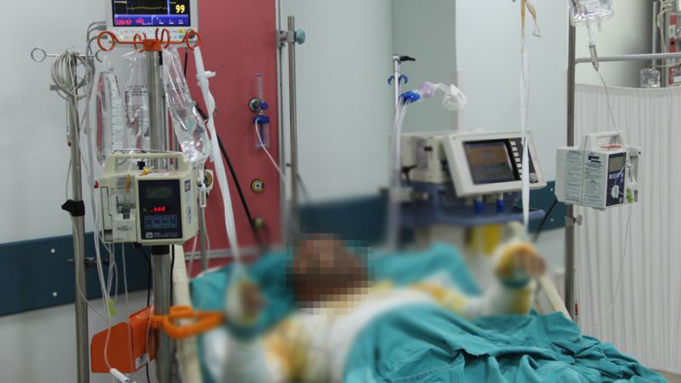 Kızı için kendini yakan Kobanili baba öldü