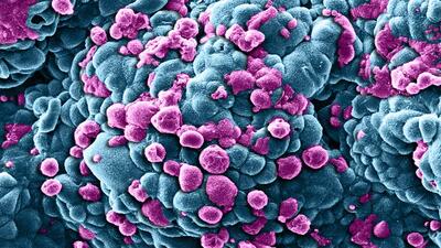 2020'de 15 milyon kişiyi tehdit edecek!