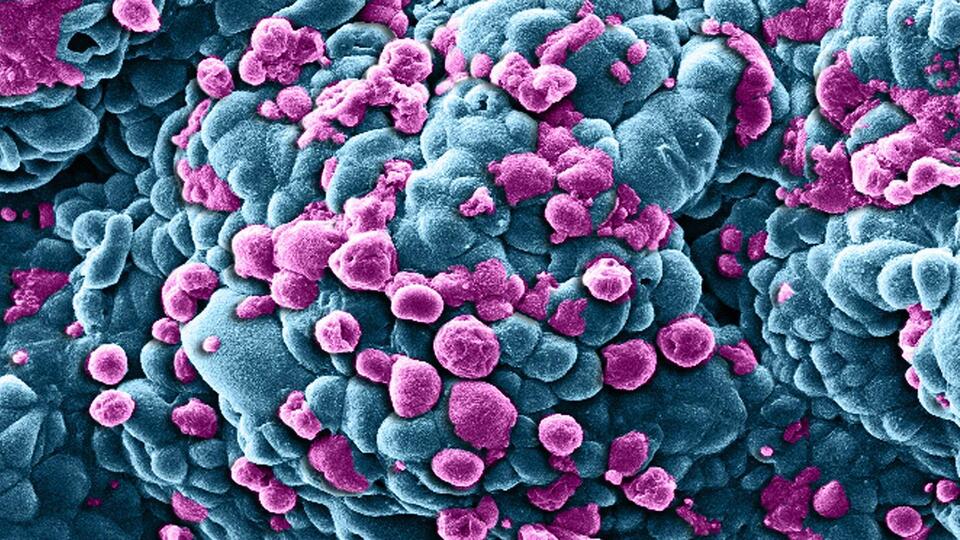 2020'de 15 milyon kişiyi tehdit edecek!