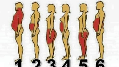 Şişmanlama nedeninizi biliyor musunuz?