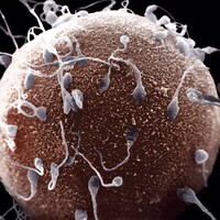 En iyi spermler seçiliyor!