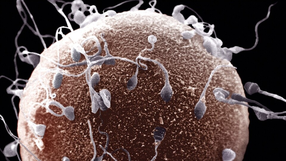 En iyi spermler seçiliyor!