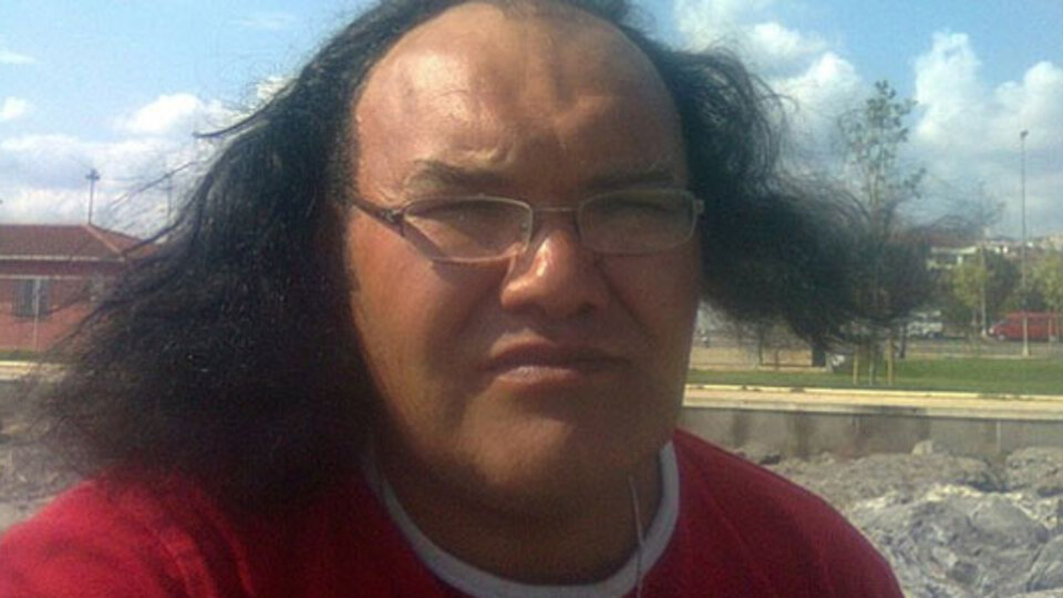 Korkunç cinayeti çürük diş aydınlattı