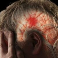 İnme her yaş grubunu tehdit ediyor!