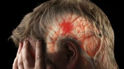 İnme her yaş grubunu tehdit ediyor!