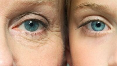 Kırışıklığın bir sebebi de...