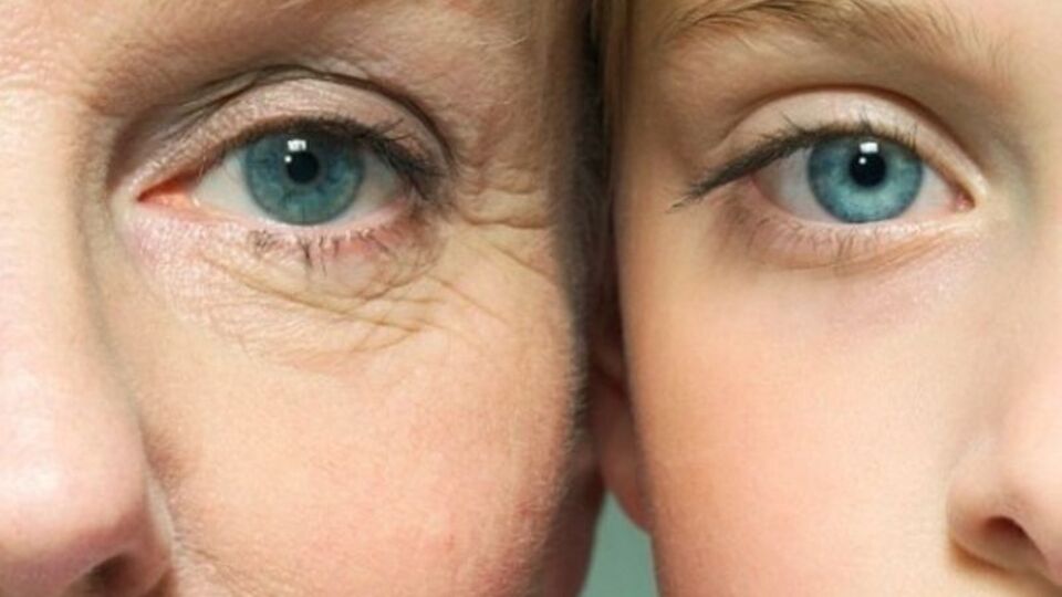 Kırışıklığın bir sebebi de...