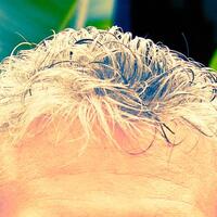 Saçlarınız beyazlıyorsa o hastalığa dikkat!