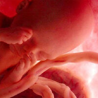 Bebeğin cinsiyetini nasıl anlarız?