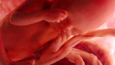 Bebeğin cinsiyetini nasıl anlarız?