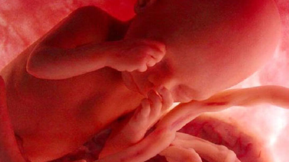 Bebeğin cinsiyetini nasıl anlarız?