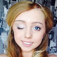 Bir gözü kapanınca gerçek ortaya çıktı!