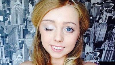 Bir gözü kapanınca gerçek ortaya çıktı!