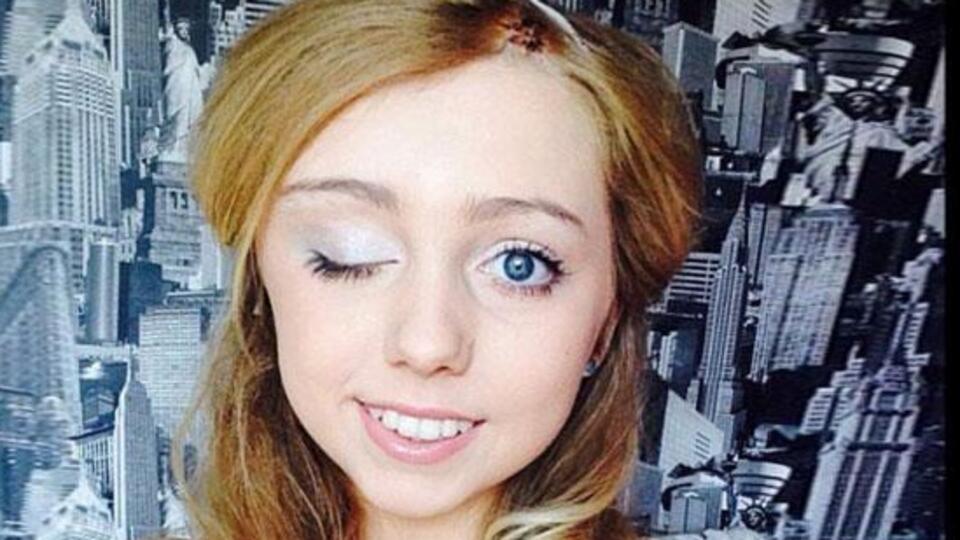 Bir gözü kapanınca gerçek ortaya çıktı!