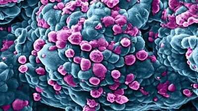 Prof. Dr. Sancar'ın keşfi kanser tedavisinde uygulanıyor…