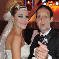 Yüz nakli olan Recep Sert baba olacak