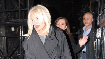 "Estetik yaptırdı yazmayın"