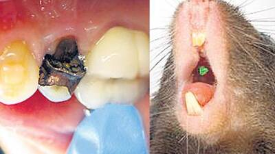 Artık takma dişlere veda...