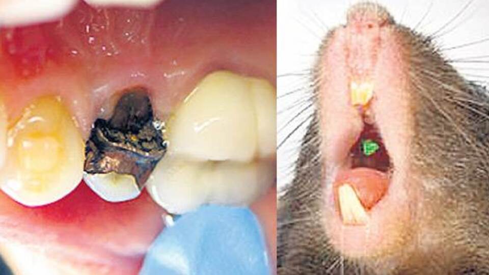 Artık takma dişlere veda...