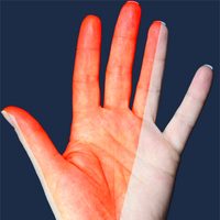 Parmakta uyuşmaya dikkat!