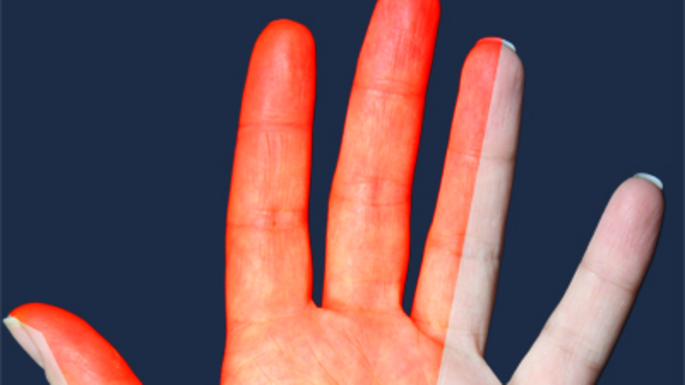 Parmakta uyuşmaya dikkat!