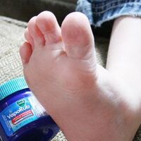 Vicks'i ayağınıza sürünce bakın ne oluyor...