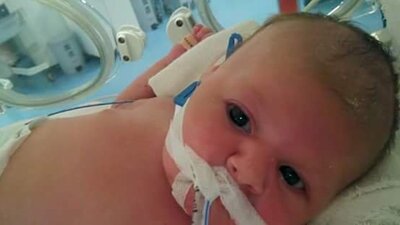 Yanlış kan verilince organları iflas etti!