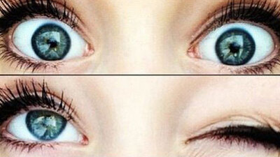 Gözleriniz uykusuzluktan şişerse...