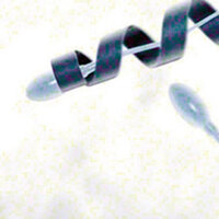 Yumurtaya ulaşmayan sperm kalmayacak