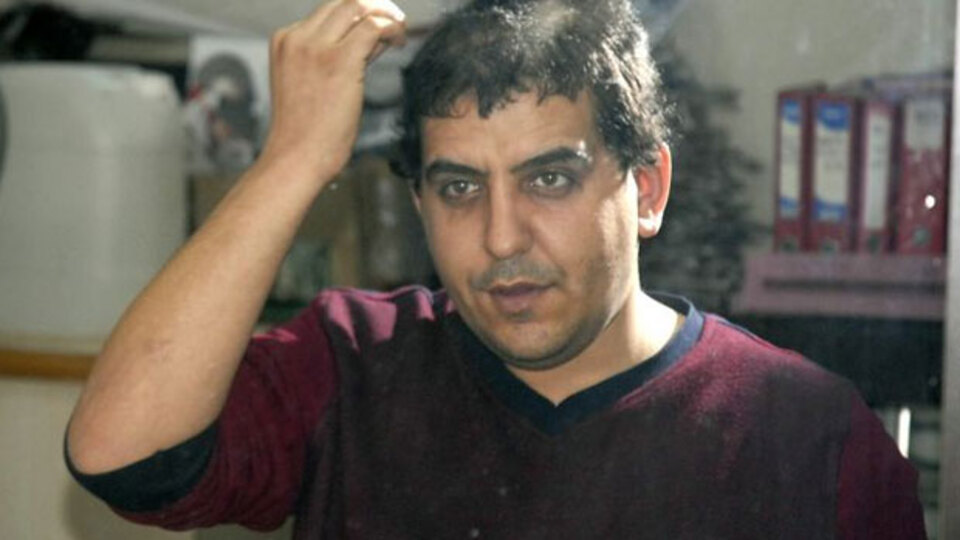 Müşterisinde denemedi, kendi başını yaktı!