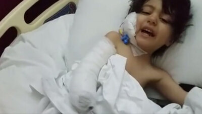 Serum nedeniyle elini kaybetti!