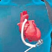 Türkiye’de ilk kez bu kalpten takıldı