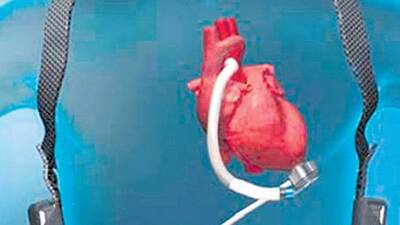 Türkiye'de ilk kez bu kalpten takıldı