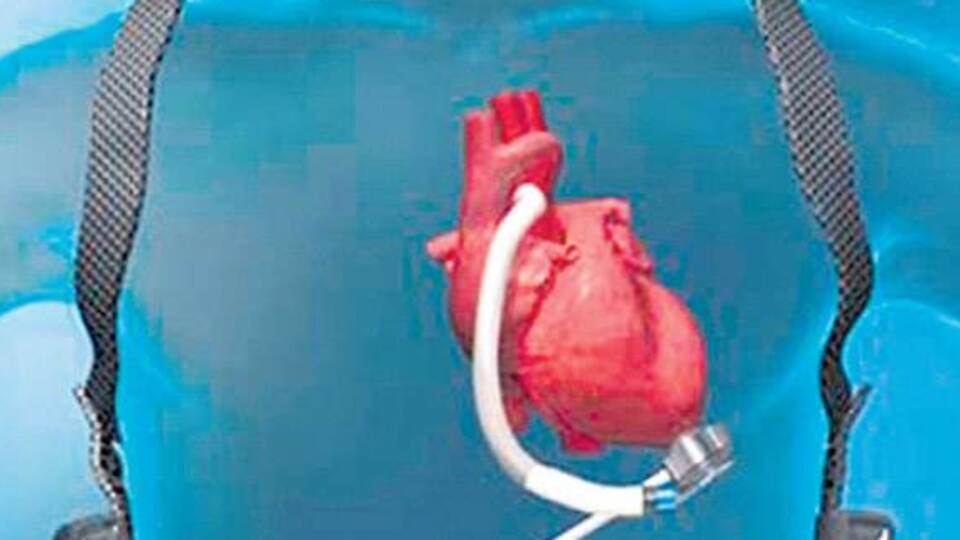 Türkiye'de ilk kez bu kalpten takıldı