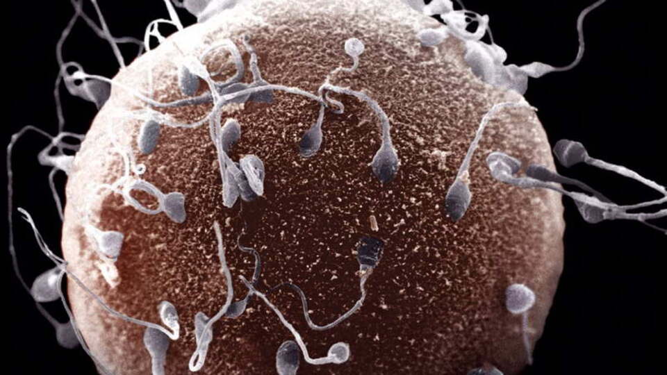 Tüp bebek tarih mi oluyor?