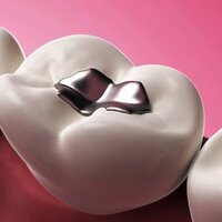 Eğer ağzınızda bunlardan varsa...