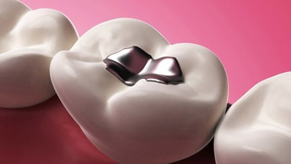 Eğer ağzınızda bunlardan varsa...