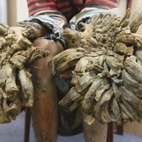 Yakında hem görme hem de işitme yetisini kaybedecek...