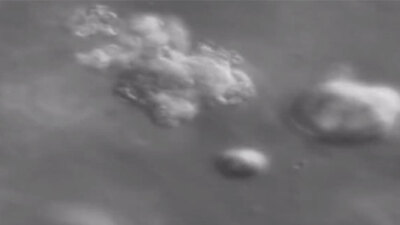 İşte kanserli bir tümörün oluşma anı!