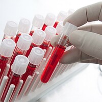 Bilim insanları yapay kan üretti!